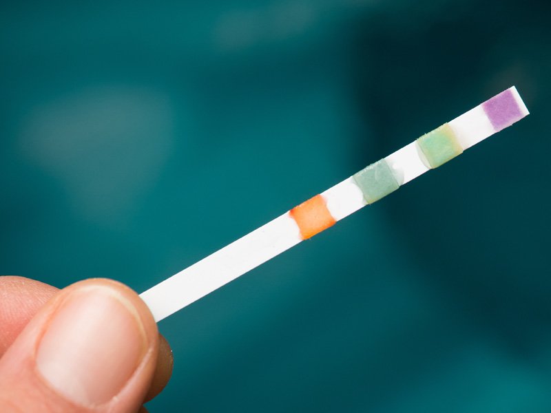 Spa alkalinity test strip